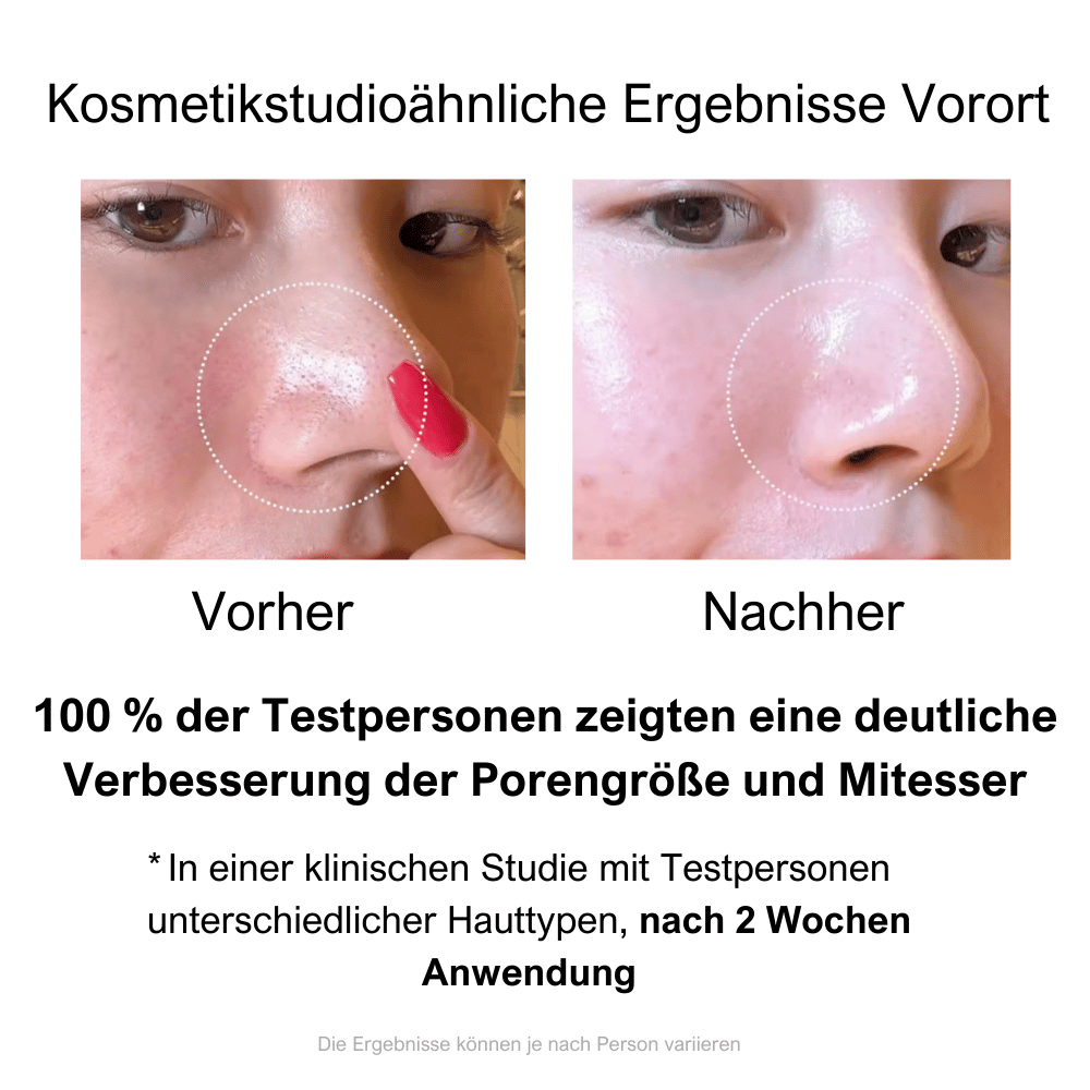 Zero-Poren-Pads